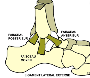 Tout savoir sur l’entorse de cheville